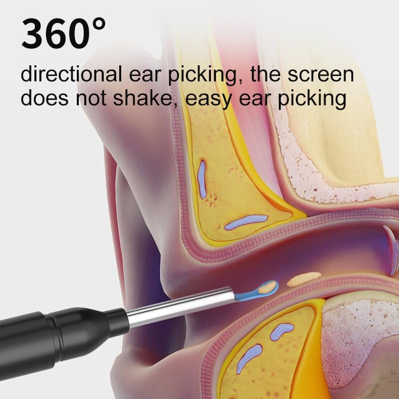 Smart Ear Cleaner Kit